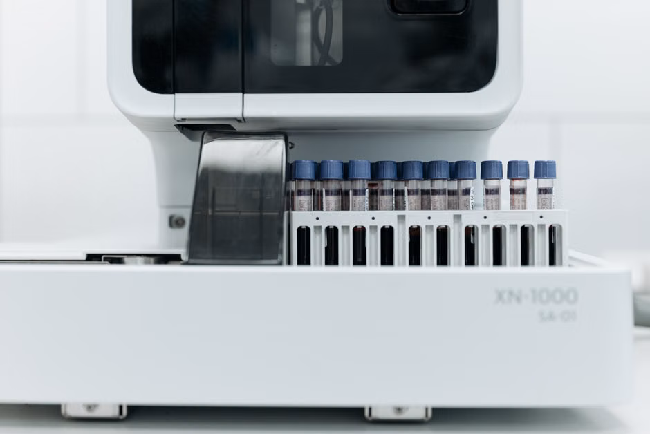 Micronutrient Panel Testing: When to Order a Comprehensive Nutrient Assessment Close-up of laboratory machine holding test tubes for analysis.