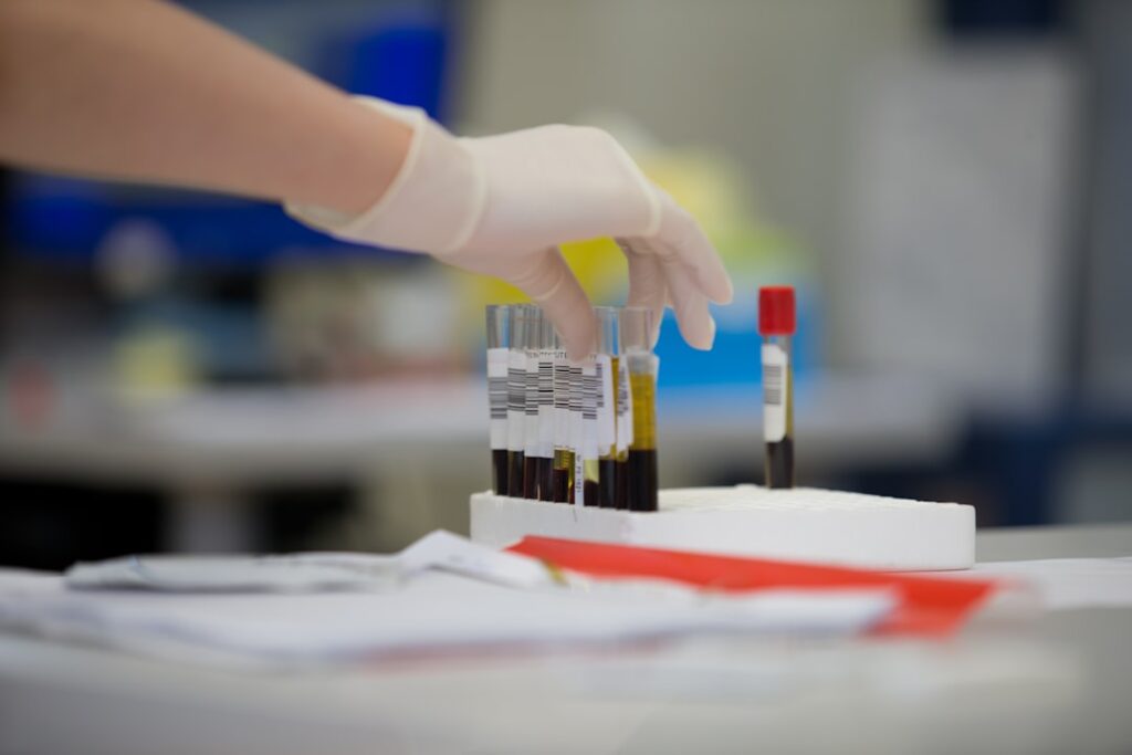 How to Read Your Complete Blood Count Results a gloved hand holding a test tube filled with blood